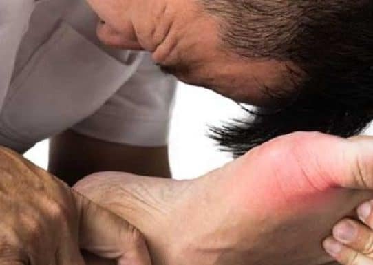 home-remedies-for-gout-pain