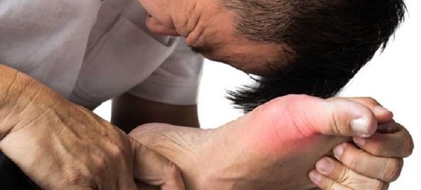 home-remedies-for-gout-pain