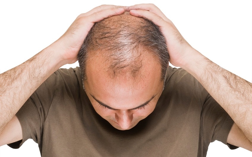 Does Diabetes Cause Hair Loss