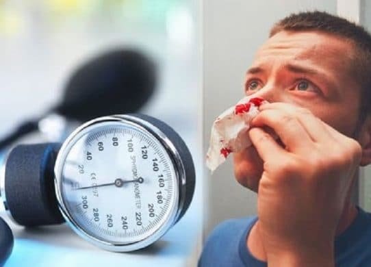 Does Having High Blood Pressure Cause Nosebleeds