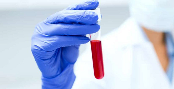 New treatment reduces blood cancer