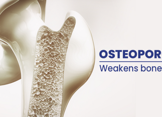 Known Minerals Risk Of Osteoporosis